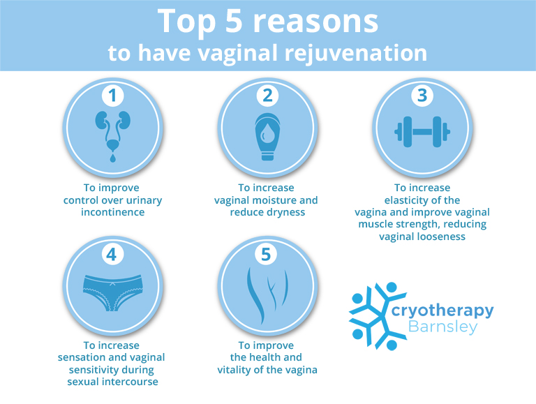 vaginal rejuvenation 5 reasons cryotherapy barnsley